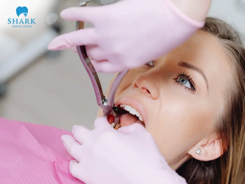 The root canal treatment process is performed under sterile conditions with extremely modern equipment