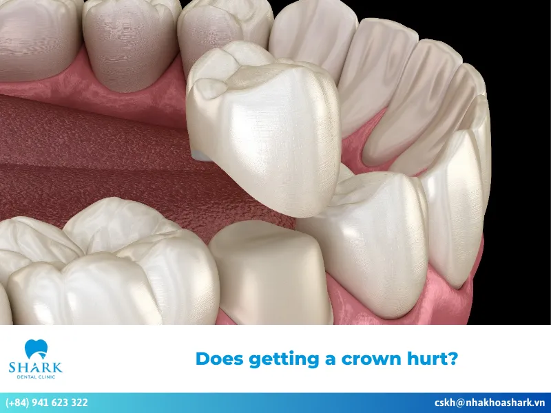 Does getting a crown hurt