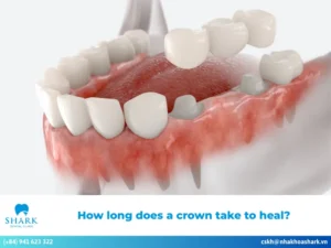 How long does a crown take to heal?