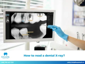 How to read a dental X-ray?