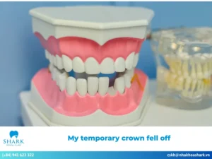 My Temporary Crown Fell Off