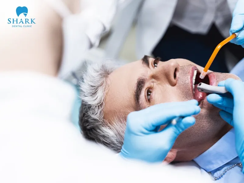 The durability of the tooth root after a root canal—before a crown is placed—depends on the dentist’s skill and technique