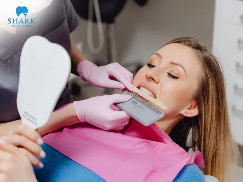 Once the crown is fully fabricated in the dental lab, it will be placed onto the prepared tooth