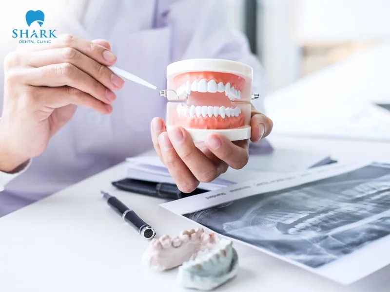 A root-canal-treated tooth that becomes chipped, cracked, or fractured can lead to a high risk of jawbone resorption