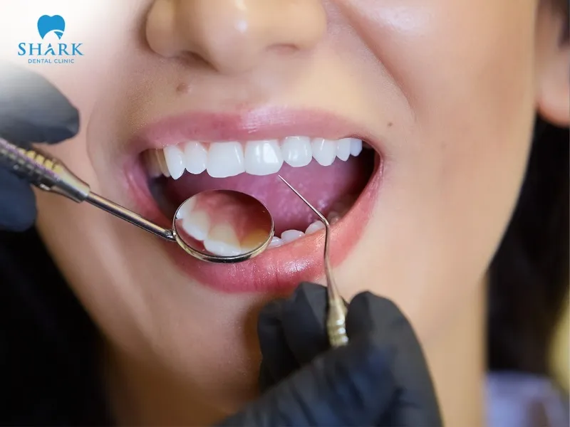 Depending on the condition of your teeth, aesthetic needs, and financial situation, you can make the most suitable choice