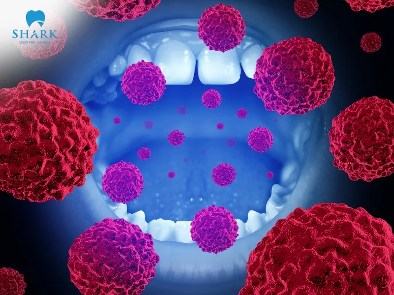 X-ray images help the dentist visualize gaps and hidden tooth structures, supporting early detection of cancer