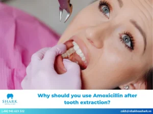 Why should you use Amoxicillin after tooth extraction?