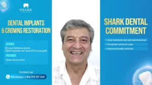 Just 4 days for a new smile!