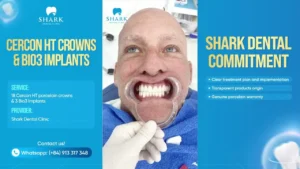 Cercon HT & Bio3 Implants create the perfect restoration