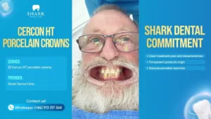 Why Shark Dental is a choice well made