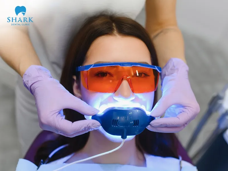 The dentist will apply a layer of whitening gel on the tooth surface, then shine LED light on it