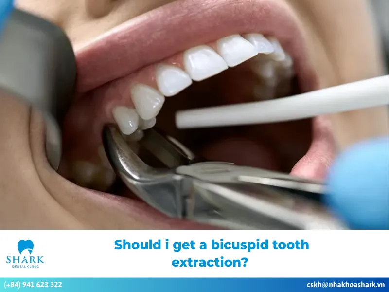 bicuspid tooth extraction