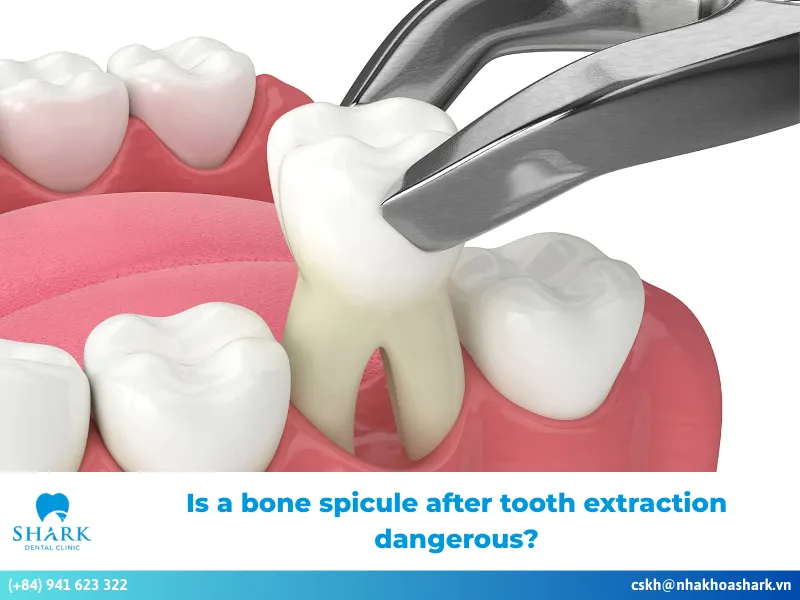 Is a bone spicule after tooth extraction dangerous?