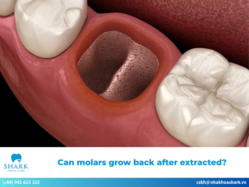 Can molars grow back after extracted?