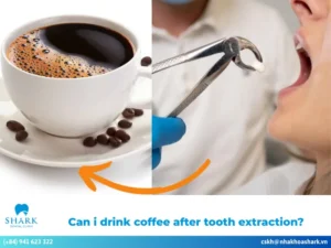 Can I drink coffee after tooth extraction?
