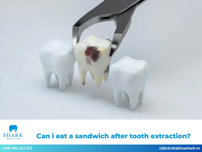 Can I eat a cheeseburger after tooth extraction?