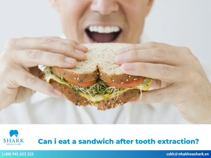 Can i eat a sandwich after tooth extraction?