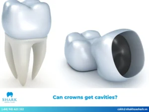 Can crowns get cavities?