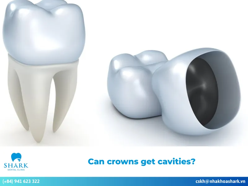 Can crowns get cavities?