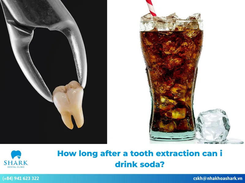 how long after a tooth extraction can i drink soda