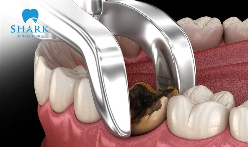 Molars cannot grow back after extraction if they are permanent teeth