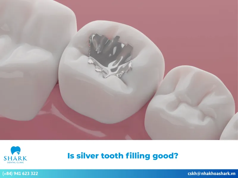 Silver tooth filling