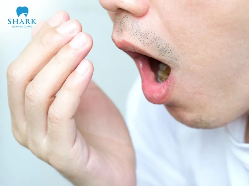 Eating a large amount of chocolate after tooth extraction may cause bad breath