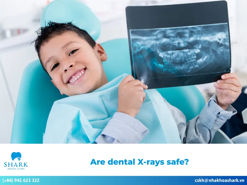 Are dental X-rays safe