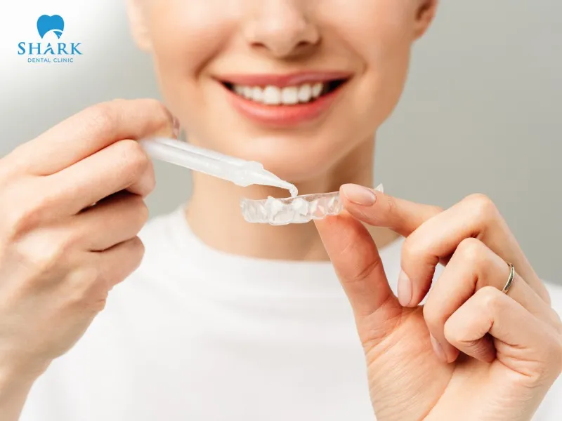 You should use a teeth whitening kit according to the instructions to ensure oral health safety