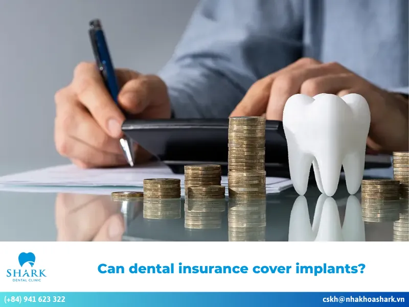 Can dental insurance cover implants