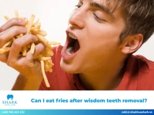 can i eat chocolate after tooth extraction