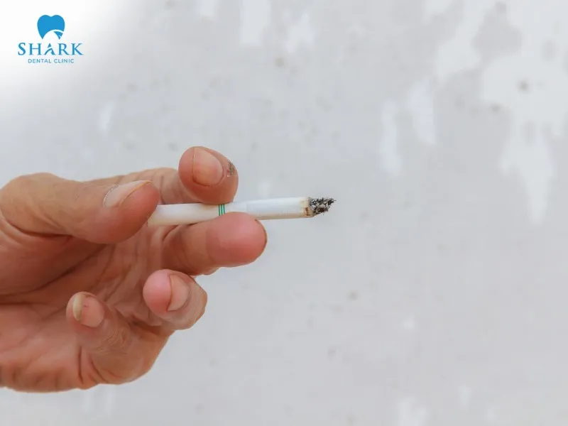 You should quit smoking before deciding to undergo dental implant placement at a dental clinic