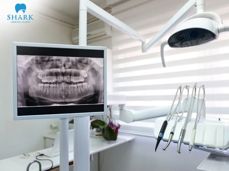 A dental X-ray can detect tooth decay through radiographic images