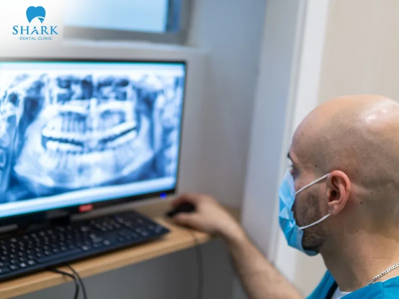 A dental X-ray may miss certain cases in the very early stages of tooth decay