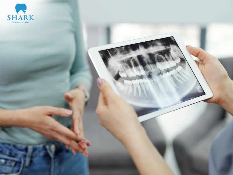 X-ray imaging allows dentists to accurately assess the bone socket’s density and height