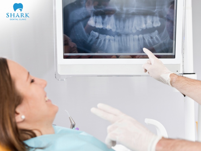When the jawbone is resorbed, deep grooves may form and can be easily observed on a dental bone loss X-ray
