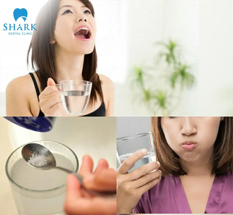 Pay close attention to oral hygiene and rinse your mouth with warm water to help minimize complications after wisdom tooth extraction