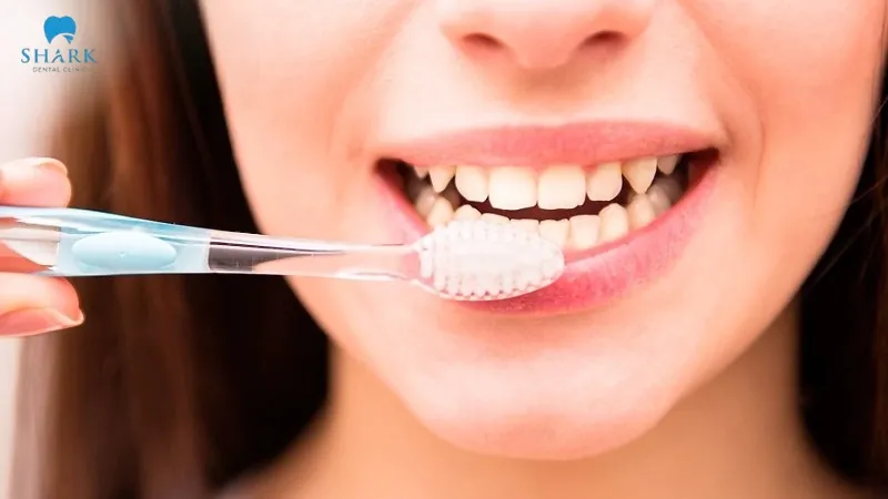 Scientific oral care is the best way to maintain the durability and aesthetic appearance of both dental implants and veneers