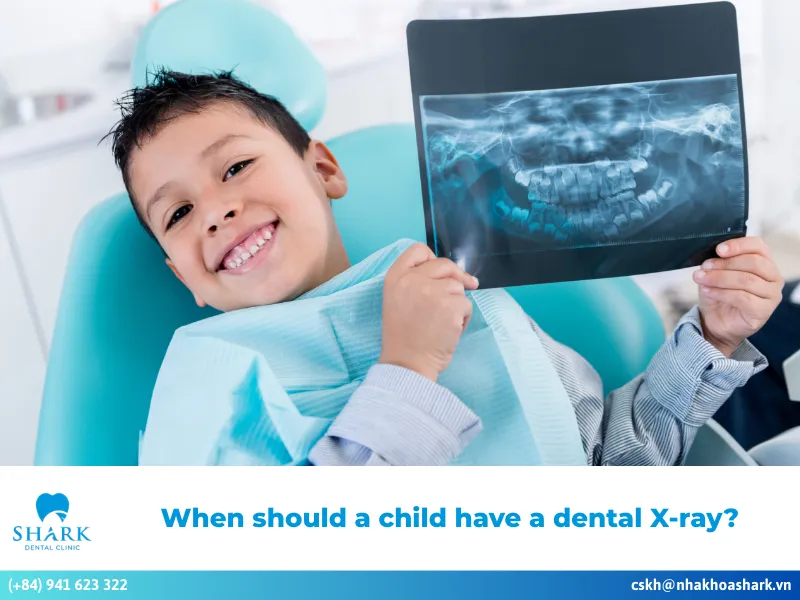When should a child have a dental X-ray?