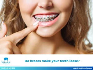 Do braces make your teeth loose