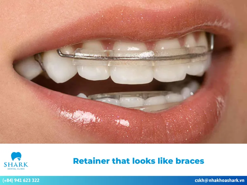 Retainer that looks like braces