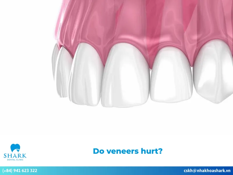 Do veneers hurt?