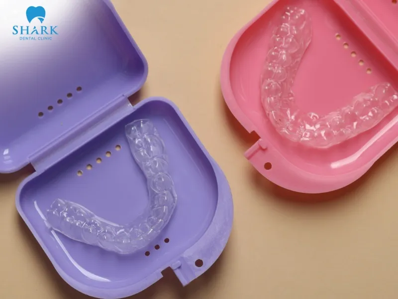 A clear retainer is designed to fit snugly around the teeth and has a transparent appearance