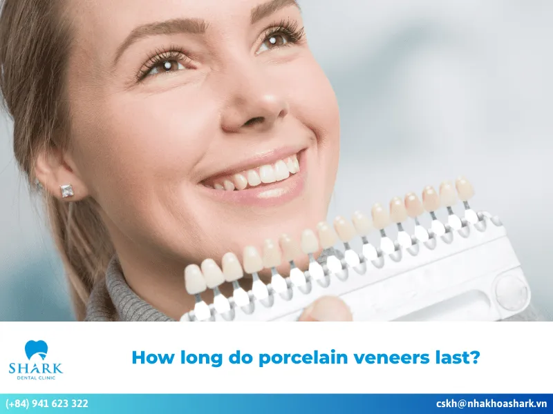 How long do porcelain veneers last?