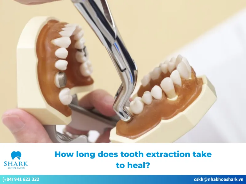 How long does tooth extraction take to heal?