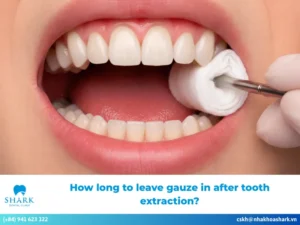 How long to leave gauze in after tooth extraction?