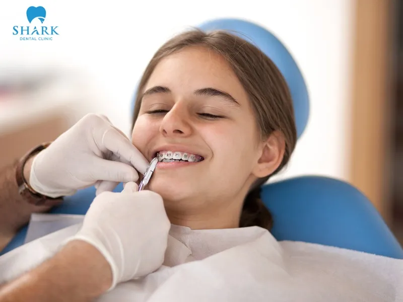 Depending on each specific case, you can choose the most suitable orthodontic method