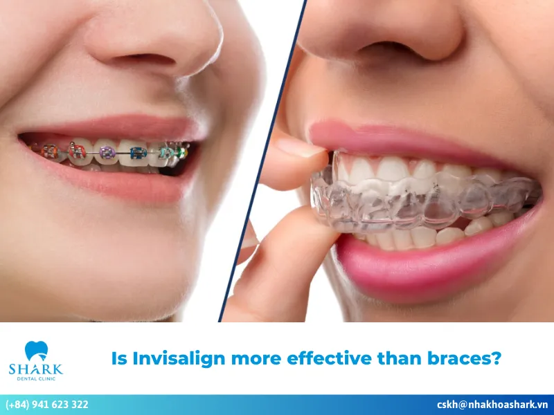 Is Invisalign more effective than braces?
