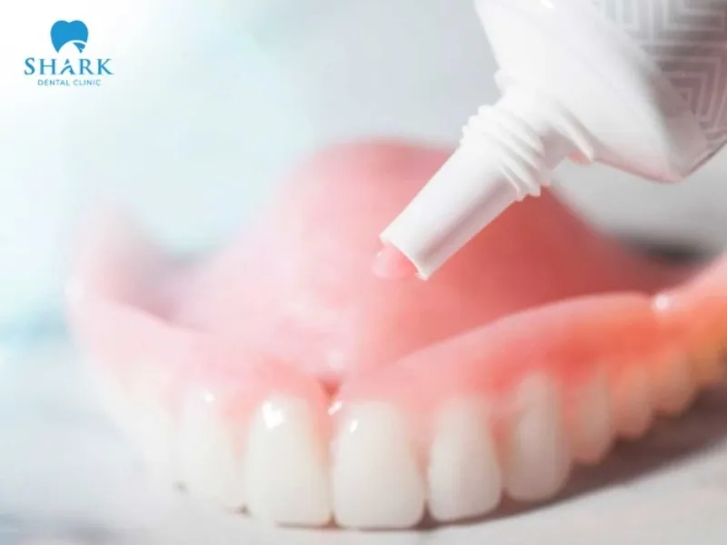Choosing the appropriate dental adhesive for veneers ensures effective restoration results and helps reduce the risk of inflammation or infection