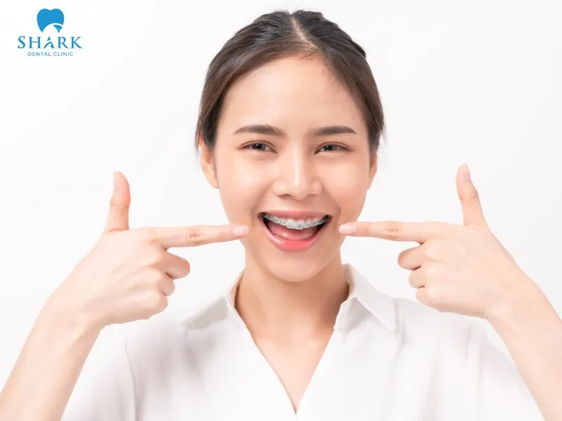 You should choose an orthodontic method based on your actual needs, the dentist’s consultation, and your financial condition